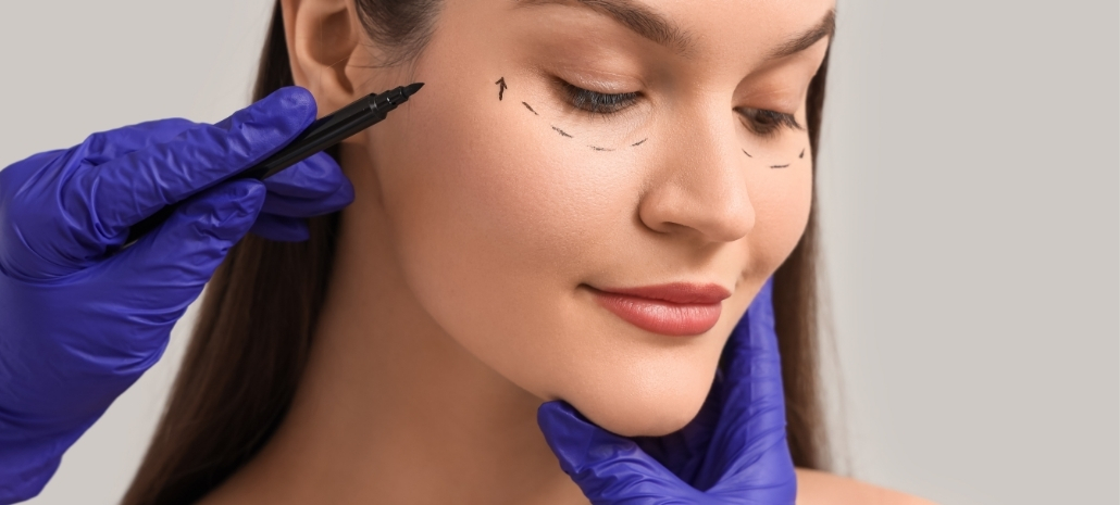 Surgeon marking incision lines around the eye before eyelid surgery