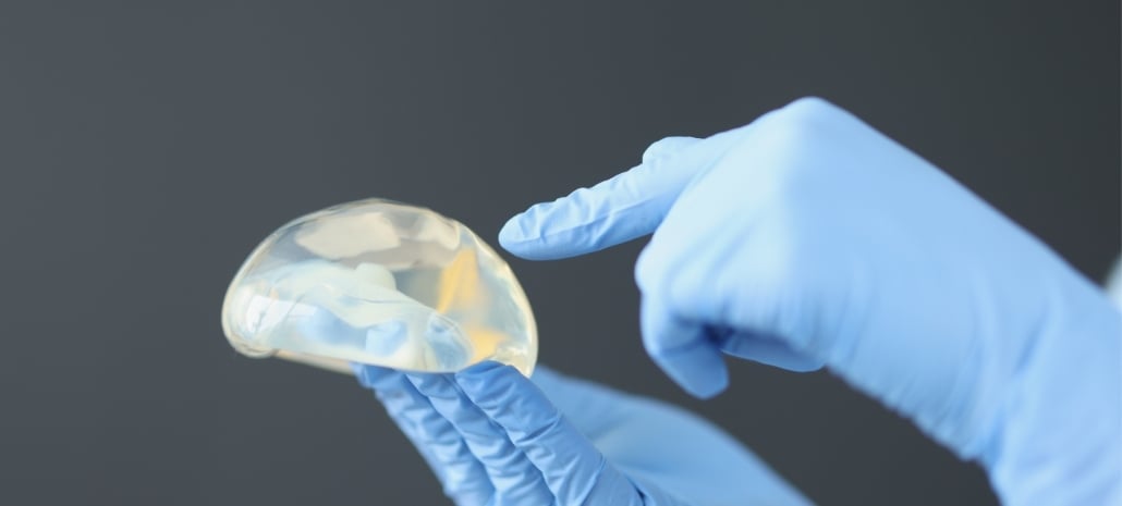 Clinician examining a smooth-walled breast implant, illustrating a safer alternative to textured implants